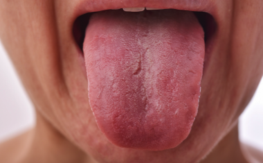 What Your Tongue Says About Your Health, according to the Traditional Chinese Medicine