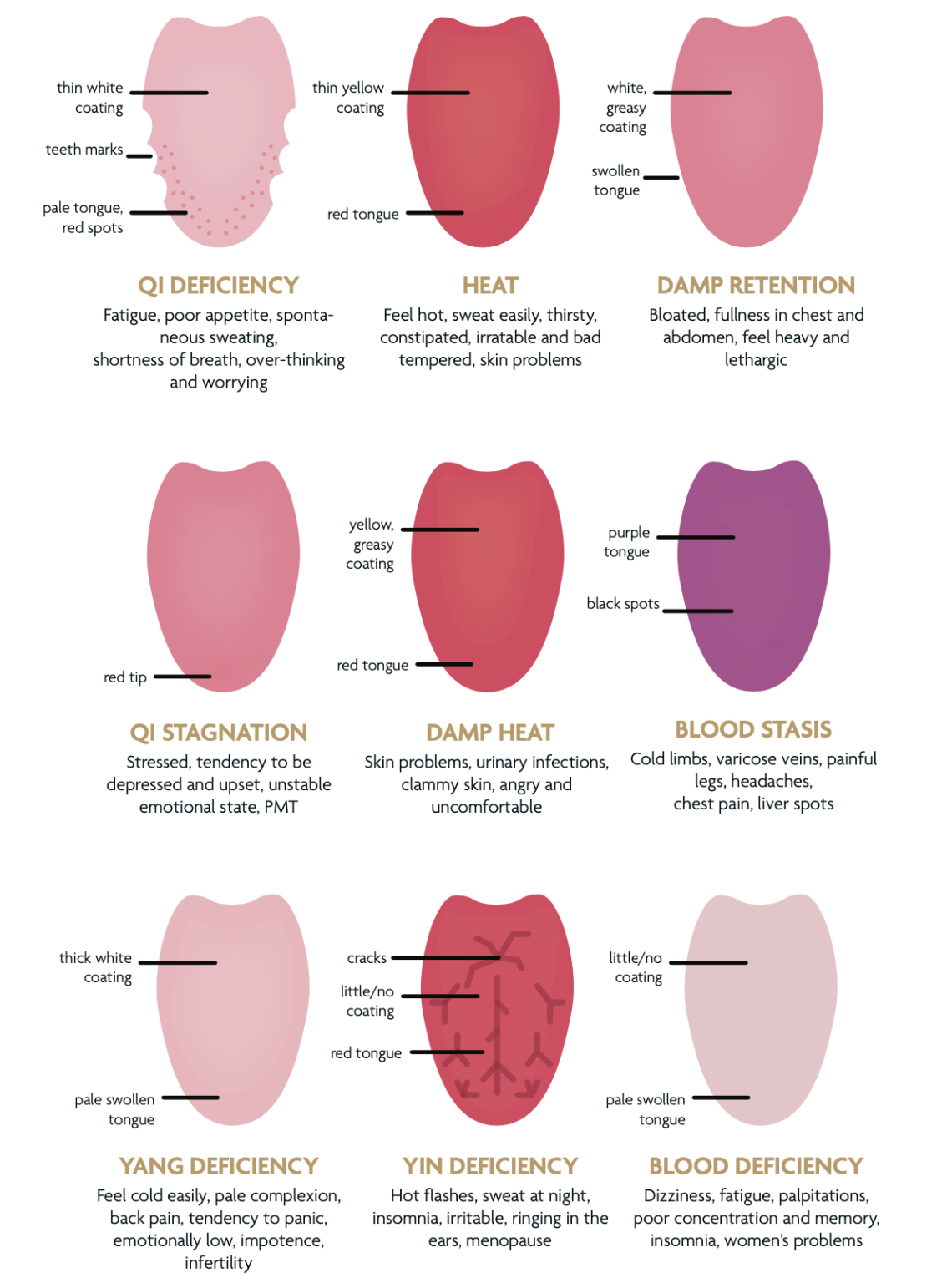 What Your Tongue Says About Your Health, according to the Traditional